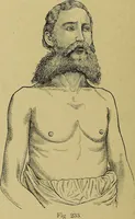 An illustration from La nuova medicina natural : trattato d'insegnamento e di consultazione sul metodo di curare e di guarire le malattie seguendo le leggi di natura / di F.E. Bilz. (1895)