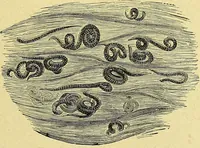 An illustration from La nuova medicina natural : trattato d'insegnamento e di consultazione sul metodo di curare e di guarire le malattie seguendo le leggi di natura / di F.E. Bilz. (1895)