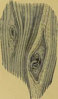 An illustration from La nuova medicina natural : trattato d'insegnamento e di consultazione sul metodo di curare e di guarire le malattie seguendo le leggi di natura / di F.E. Bilz. (1895)