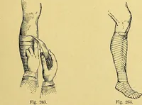An illustration from La nuova medicina natural : trattato d'insegnamento e di consultazione sul metodo di curare e di guarire le malattie seguendo le leggi di natura / di F.E. Bilz. (1895)