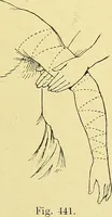 An illustration from La nuova medicina natural : trattato d'insegnamento e di consultazione sul metodo di curare e di guarire le malattie seguendo le leggi di natura / di F.E. Bilz. (1895)