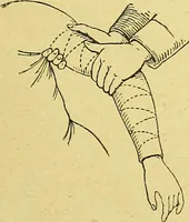 An illustration from La nuova medicina natural : trattato d'insegnamento e di consultazione sul metodo di curare e di guarire le malattie seguendo le leggi di natura / di F.E. Bilz. (1895)