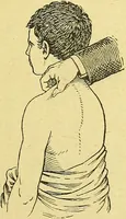 An illustration from La nuova medicina natural : trattato d'insegnamento e di consultazione sul metodo di curare e di guarire le malattie seguendo le leggi di natura / di F.E. Bilz. (1895)
