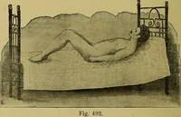 An illustration from La nuova medicina natural : trattato d'insegnamento e di consultazione sul metodo di curare e di guarire le malattie seguendo le leggi di natura / di F.E. Bilz. (1895)