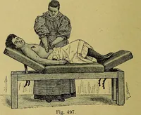 An illustration from La nuova medicina natural : trattato d'insegnamento e di consultazione sul metodo di curare e di guarire le malattie seguendo le leggi di natura / di F.E. Bilz. (1895)