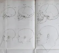 An illustration from Dissertation physique de Mr. Pierre Camper, sur les différences réelles que présentent les traits du visage chez les hommes de différents pays et de différents âges, sur le beau qui caractèrise les statues antiques et les pierres gravées : suivie de la proposition d'une nouvelle méthode pour déssiner toutes sortes de têtes humaines avec la plus grande sûreté / publiée après le décès de l'auteur par son fils Adrien Gilles Camper ; traduite du hollandois par Denis Bernard Quatremere d'Isjonval. (1791)
