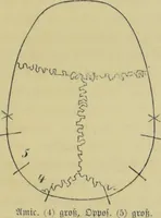 Picture 3 of 29 from Phrenologische Bilder : zur Naturlehre des menschlichen Geistes und deren Anwendung auf Wissenschaft und Leben auch zur Verständigung zwischen Phrenologie und Anthropologie / von Gustav Scheve. (1874), leaf 191