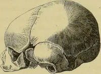 An illustration from Phrenologische Bilder : zur Naturlehre des menschlichen Geistes und deren Anwendung auf Wissenschaft und Leben auch zur Verständigung zwischen Phrenologie und Anthropologie / von Gustav Scheve. (1874)