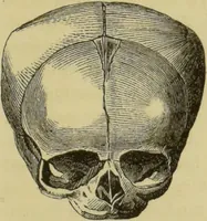 An illustration from Phrenologische Bilder : zur Naturlehre des menschlichen Geistes und deren Anwendung auf Wissenschaft und Leben auch zur Verständigung zwischen Phrenologie und Anthropologie / von Gustav Scheve. (1874)