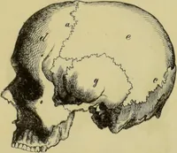 An illustration from Phrenologische Bilder : zur Naturlehre des menschlichen Geistes und deren Anwendung auf Wissenschaft und Leben auch zur Verständigung zwischen Phrenologie und Anthropologie / von Gustav Scheve. (1874)