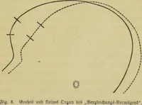 An illustration from Phrenologische Bilder : zur Naturlehre des menschlichen Geistes und deren Anwendung auf Wissenschaft und Leben auch zur Verständigung zwischen Phrenologie und Anthropologie / von Gustav Scheve. (1874)