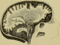 An illustration from Phrenologische Bilder : zur Naturlehre des menschlichen Geistes und deren Anwendung auf Wissenschaft und Leben auch zur Verständigung zwischen Phrenologie und Anthropologie / von Gustav Scheve. (1874)