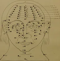 An illustration from Moles, or birth-marks, and their signification to man and woman / by Maud Wheeler. (1894)
