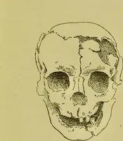 An illustration from Phrenology, or, Heads, and what they tell us / by W. Pugin Thornton. (1896)