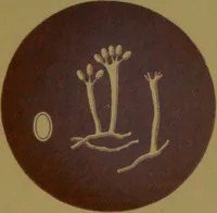Picture 17 of 19 from Rust, smut, mildew & mould : An introduction to the study of microscopic fungi / by M. C. Cooke. Illustrated with 269 coloured figures, by J. E. Sowerby. (1886), leaf 193