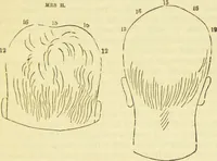 An illustration from The constitution of man considered in relation to external objects / [George Combe]. (1879)