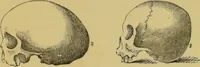 An illustration from Elements of phrenology / by George Combe. (1862)