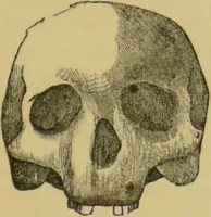An illustration from Elements of phrenology / by George Combe. (1862)
