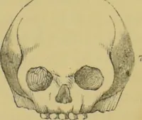An illustration from Elements of phrenology / by George Combe. (1862)