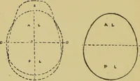 Picture 7 of 15 from How to read heads, or, Practical physiognomy made easy : the science and art of reading character briefly outlined, illustrated, and explained / by James Coates. (1890), leaf 46