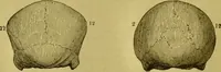 Picture 13 of 41 from Orthodox phrenology / by A.L. Vago. (1871), leaf 36