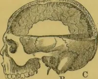 Picture 13 of 46 from Elements of phrenology / by George Combe. (1855), leaf 65