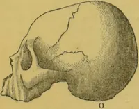 Picture 17 of 46 from Elements of phrenology / by George Combe. (1855), leaf 79