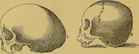 An illustration from Elements of phrenology / by George Combe. (1855)