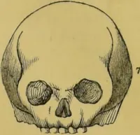 Picture 27 of 46 from Elements of phrenology / by George Combe. (1855), leaf 95