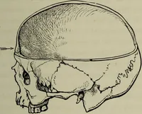 An illustration from Phrenology vindicated : being a reply to the article by Dr Andrew Wilson, entitled "The old phrenology and the new", which appeared in "The gentleman's magazine", January, 1879 / by A.L. Vago. (1879)