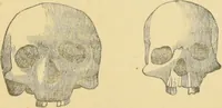 Picture 10 of 29 from Lectures on phrenology / by George Combe ; including its application to the present and prospective condition of the United States, with notes, an introductory essay, and a historical sketch by Andrew Boardman. (1889), leaf 163
