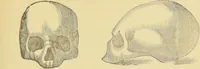 An illustration from Lectures on phrenology / by George Combe ; including its application to the present and prospective condition of the United States, with notes, an introductory essay, and a historical sketch by Andrew Boardman. (1889)