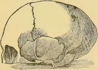 An illustration from Lectures on phrenology / by George Combe ; including its application to the present and prospective condition of the United States, with notes, an introductory essay, and a historical sketch by Andrew Boardman. (1889)