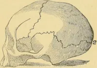 An illustration from Lectures on phrenology / by George Combe ; including its application to the present and prospective condition of the United States, with notes, an introductory essay, and a historical sketch by Andrew Boardman. (1889)