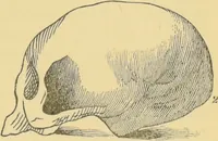 An illustration from Lectures on phrenology / by George Combe ; including its application to the present and prospective condition of the United States, with notes, an introductory essay, and a historical sketch by Andrew Boardman. (1889)