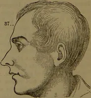 An illustration from New illustrated self-instructor in phrenology and physiology : with over one hundred engravings, together with the chart and character of ... as marked by ... / by O.S. and L.N. Fowler. (1852)