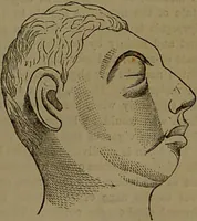An illustration from New illustrated self-instructor in phrenology and physiology : with over one hundred engravings, together with the chart and character of ... as marked by ... / by O.S. and L.N. Fowler. (1852)