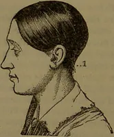 An illustration from New illustrated self-instructor in phrenology and physiology : with over one hundred engravings, together with the chart and character of ... as marked by ... / by O.S. and L.N. Fowler. (1852)