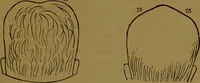 An illustration from New illustrated self-instructor in phrenology and physiology : with over one hundred engravings, together with the chart and character of ... as marked by ... / by O.S. and L.N. Fowler. (1864)