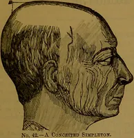 Picture 26 of 63 from New illustrated self-instructor in phrenology and physiology : with over one hundred engravings, together with the chart and character of ... as marked by ... / by O.S. and L.N. Fowler. (1864), leaf 73
