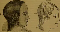 An illustration from New illustrated self-instructor in phrenology and physiology : with over one hundred engravings, together with the chart and character of ... as marked by ... / by O.S. and L.N. Fowler. (1864)
