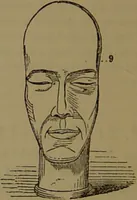 An illustration from New illustrated self-instructor in phrenology and physiology : with over one hundred engravings, together with the chart and character of ... as marked by ... / by O.S. and L.N. Fowler. (1872)