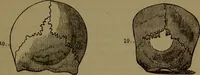 Picture 39 of 63 from New illustrated self-instructor in phrenology and physiology : with over one hundred engravings, together with the chart and character of ... as marked by ... / by O.S. and L.N. Fowler. (1872), leaf 107