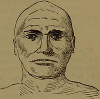An illustration from New illustrated self-instructor in phrenology and physiology : with over one hundred engravings, together with the chart and character of ... as marked by ... / by O.S. and L.N. Fowler. (1872)