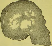 Picture 36 of 160 from How to study strangers by temperament, face and head : A sequel to "Heads and faces" / by Nelson Sizer. (1895), leaf 53