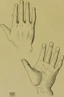 An illustration from A manual of cheirosophy : being a complete practical handbook of the twin sciences of cheirognomy and cheiromancy, by means whereof the past, the present, and the future may be read in the formations of the hands ; preceded by an introductory argument upon the science of cheirosophy and its claims to rank as a physical science / by Ed. Heron-Allen ... with full-page and other illustrations by Rosamund Brunel Horsley. (1892)