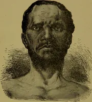 An illustration from Faces we meet, and, how to read them / by R.B.D. Wells. (1880)