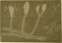 An illustration from Flore pittoresque de la France : anatomie, physiologie, classification, description des plantes indigènes et cultivées au point de vue de l'agriculture, de l'horticulture et de la sylviculture / publiée sous la direction de J. Rothschild. (1885)