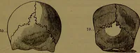 An illustration from Fowler's New illustrated self-instructor in phrenology and physiology : with over one hundred engravings, together with the chart and character of ... as marked by ... / by Lorenzo N. Fowler. (1893)