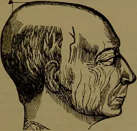 An illustration from Fowler's New illustrated self-instructor in phrenology and physiology : with over one hundred engravings, together with the chart and character of ... as marked by ... / by Lorenzo N. Fowler. (1893)